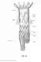 Fig. 10 - Low profile non-symmetrical stent