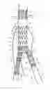 Fig. 01 - Locking mechanism for securing the interface between stent grafts