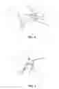 Fig. 03 - Apparatus and method for ligament reconstruction