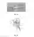 Fig. 05 - Apparatus and method for ligament reconstruction