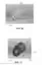 Fig. 14 - Apparatus and method for ligament reconstruction