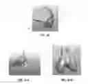 Fig. 19 - Apparatus and method for ligament reconstruction