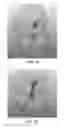 Fig. 32 - Apparatus and method for ligament reconstruction