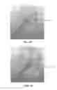 Fig. 33 - Apparatus and method for ligament reconstruction