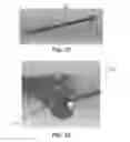 Fig. 37 - Apparatus and method for ligament reconstruction