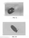 Fig. 40 - Apparatus and method for ligament reconstruction