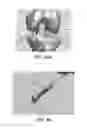 Fig. 46 - Apparatus and method for ligament reconstruction