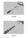Fig. 47 - Apparatus and method for ligament reconstruction