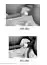 Fig. 48 - Apparatus and method for ligament reconstruction