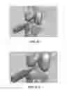 Fig. 50 - Apparatus and method for ligament reconstruction