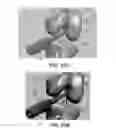 Fig. 52 - Apparatus and method for ligament reconstruction