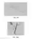 Fig. 62 - Apparatus and method for ligament reconstruction