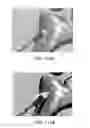 Fig. 64 - Apparatus and method for ligament reconstruction