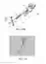 Fig. 66 - Apparatus and method for ligament reconstruction