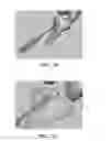 Fig. 67 - Apparatus and method for ligament reconstruction