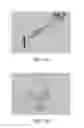 Fig. 68 - Apparatus and method for ligament reconstruction