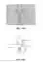 Fig. 70 - Apparatus and method for ligament reconstruction