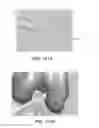 Fig. 72 - Apparatus and method for ligament reconstruction