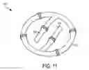 Fig. 15 - Implantable devices and techniques for oncoplastic surgery