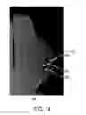 Fig. 20 - Implantable devices and techniques for oncoplastic surgery