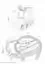 Fig. 02 - Mitral valve anchoring