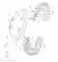Fig. 07 - Mitral valve anchoring