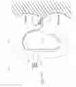Fig. 17 - Mitral valve anchoring