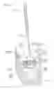 Fig. 22 - Mitral valve anchoring