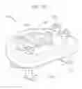 Fig. 25 - Mitral valve anchoring