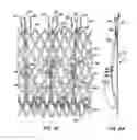 Fig. 02 - Everting heart valve