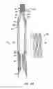 Fig. 04 - Everting heart valve