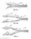Fig. 06 - Everting heart valve