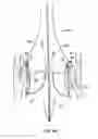 Fig. 18 - Everting heart valve
