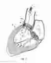 Fig. 20 - Everting heart valve
