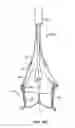 Fig. 22 - Everting heart valve