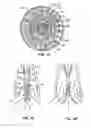 Fig. 23 - Everting heart valve