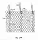 Fig. 30 - Everting heart valve
