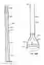 Fig. 40 - Everting heart valve