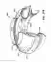 Fig. 47 - Everting heart valve