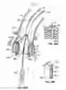 Fig. 53 - Everting heart valve