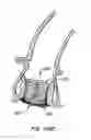Fig. 58 - Everting heart valve