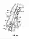 Fig. 59 - Everting heart valve