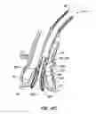 Fig. 61 - Everting heart valve
