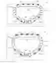 Fig. 01 - Systems and methods for delivery of annuloplasty rings