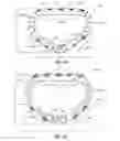 Fig. 02 - Systems and methods for delivery of annuloplasty rings