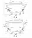 Fig. 04 - Systems and methods for delivery of annuloplasty rings
