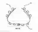 Fig. 11 - Systems and methods for delivery of annuloplasty rings