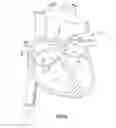 Fig. 13 - Systems and methods for delivery of annuloplasty rings