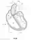Fig. 14 - Systems and methods for delivery of annuloplasty rings