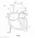 Fig. 15 - Systems and methods for delivery of annuloplasty rings
